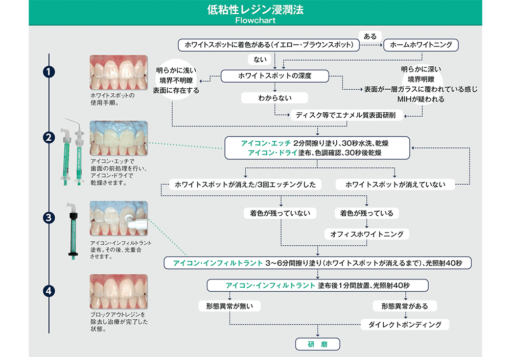 治療の流れ